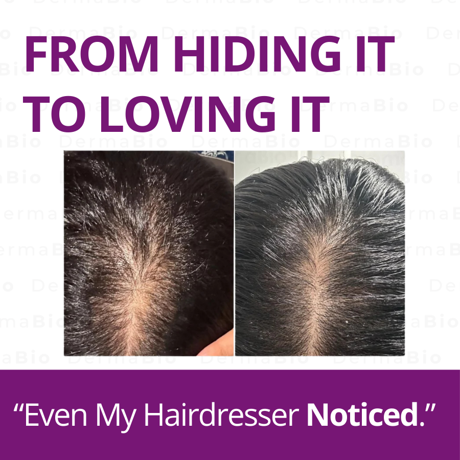 Hair Growth Accelerator (40x Biotin) Fruity Soft Chew