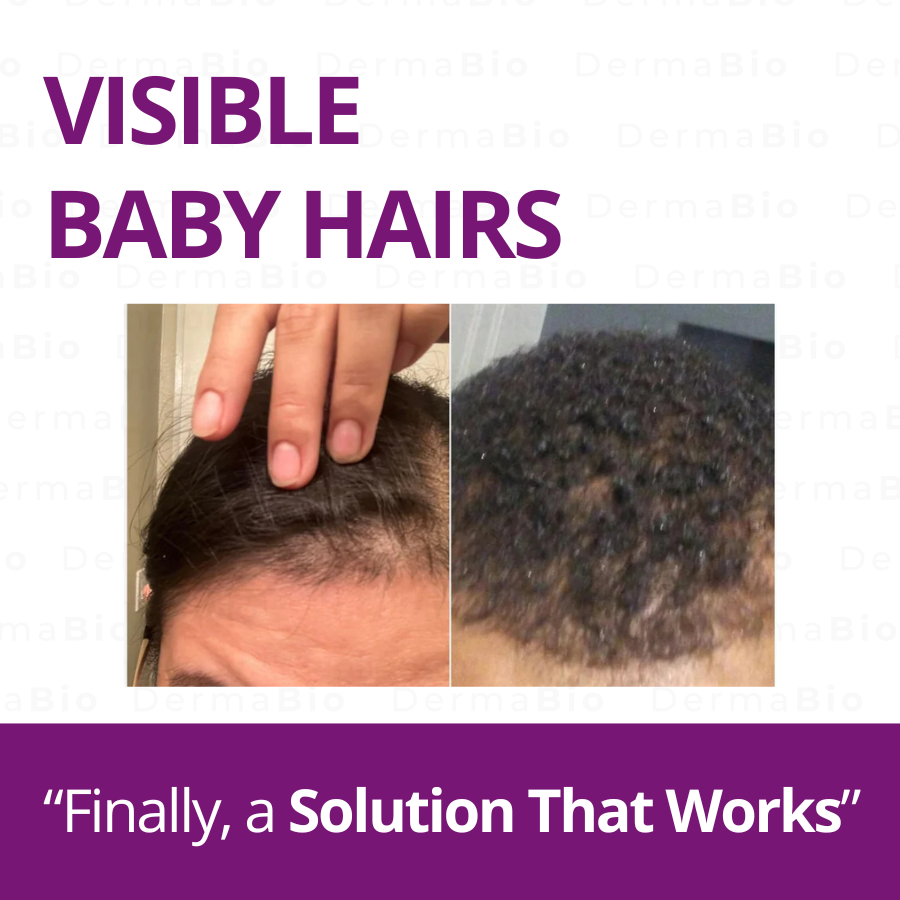 Hair Growth Accelerator (40x Biotin) Fruity Soft Chew